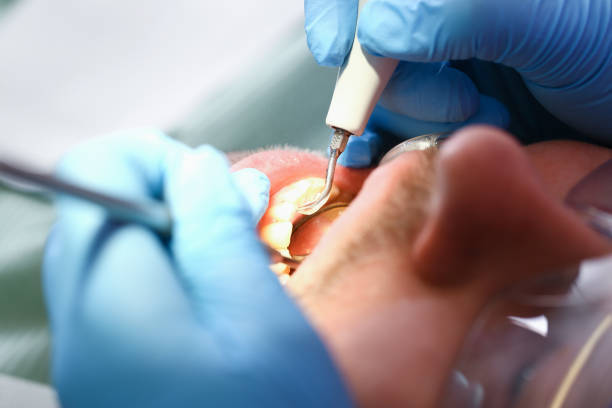 Best Urgent Care for Lost Fillings or Crowns in Zebulon, NC